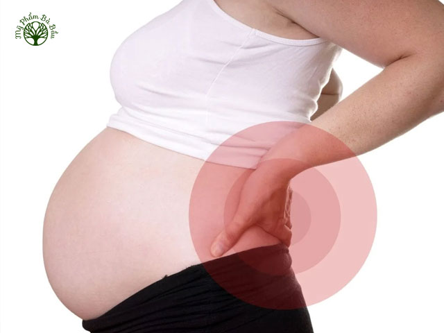 Đau lưng là một trong những “đặc sản” khi mang thai